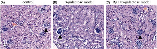 Figure 1. Effect of Rg1 on the kidney structure of d-galactose model mice (HE stain,  ×100). ▴: glomerulus.