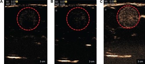 Figure 5 Ultrasonograph of the bladder in the normal rats.Notes: (A) Preinjection, (B) injection of double-distilled H2O, and (C) injection of nanodroplets. Red-circled areas indicate monitoring region.