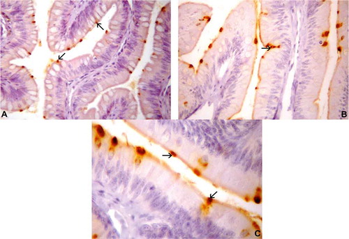 Figure 2. Photomicrographs of gastrin-immunoreactive (IR) cells in the intestine of Tropidurus torquatus. (A–C) Small intestine. A, Gastrin-IR cells between the epithelial cells (arrows) (270×). B, Gastrin-IR cells of the epithelium of the intestinal folds, a few of the open type (arrow) and most of the closed type (740×). C, Highlighting the existence of closed cell types (arrows; 1000×).