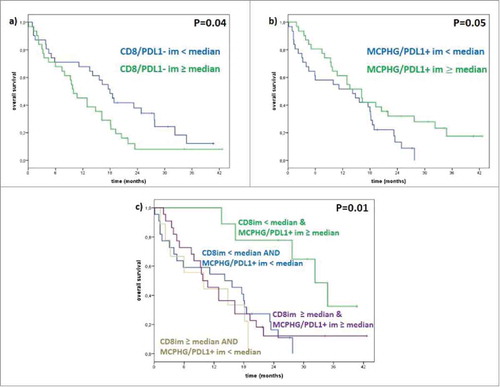 Figure 2. Correlation between PD-L1 status with CD8 and CD163. (a) Median OS in patients with low CD8+/PD-L1- is 18 months and in patients with high CD8+/PD-L1- is 10 months (p-value 0.04); (b) median OS in patients with low CD163+PD-L1+ is 14 months and in patients with high CD163+PD-L1+ is 16 months (p-value 0.05); (c) median OS in patients with a low CD8+/PD-L1- and high CD163+/PD-L1+ in invasive margin is 32 months, in patients with a low CD8+/PD-L1- and low CD163+/PD-L1+ in invasive margin is 16 months in patients with a high CD8+/PD-L1- and high CD163+/PD-L1+ in invasive margin is 11 months, in patients with a high CD8+/PD-L1- and low CD163+/PD-L1+ in invasive margin is 6 months (p-value 0.01).