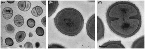 Figure 5. Transmission electron micrographs of untreated MRSA cells showing normal cell shapes and cell division activity.