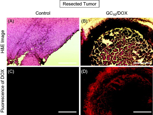 Figure 9. H&E stained images of dissected tumor tissues and fluorescence of DOX in the tumor tissues. The white scale bars indicate 300 μm.