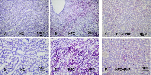 Figure 4. Effect of feeding Phellinus pini on hepatocyte cells in rats. (A–C) oil red O stained photomicrographs at 100×; (D–F) photomicrographs of red O stain at 400×. NC: normal control diet; HFC: high fat and cholesterol diet; HFC + PhP: high fat and cholesterol diet supplemented with 5% Phellinus pini fruiting body powder.