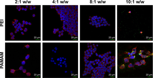 Figure S5 Fluorescence microscopy of HEK 293 cells treated with polymers compared to polymer-coated CNTs complexed with FAM-miR-503 at different weight ratios.Note: Magnification 60×.Abbreviations: CNTs, carbon nanotubes; MWCNTs, multi-walled CNTs; PAMAM, polyamidoamine dendrimer; PEI, polyethyleneimine.
