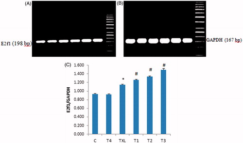Figure 4. Effect of taxol (TXL) and royal jelly on E2f1 (198 bp) (A) and GAPDH (167 bp) (B) mRNA levels in the testicular tissue. The levels of E2f1 and GAPDH mRNA were evaluated by semi-quantitative RT-PCR. (C) The density of E2f1 mRNA in the testis that were measured by densitometry and normalized to GAPDH mRNA expression level. Results were expressed as integrated density values (IDV) of E2f1 mRNA level. C: control; TXL: taxol-received animals; T1, T2, T3: The TXL-recieved animals which treated with various dose levels of RJ; T4: received RJ only. *indicates significant differences (p < 0.05) between the control (C) and TXL-treated animals; #represents remarkable difference between TXL-received non-treated and treated animals.