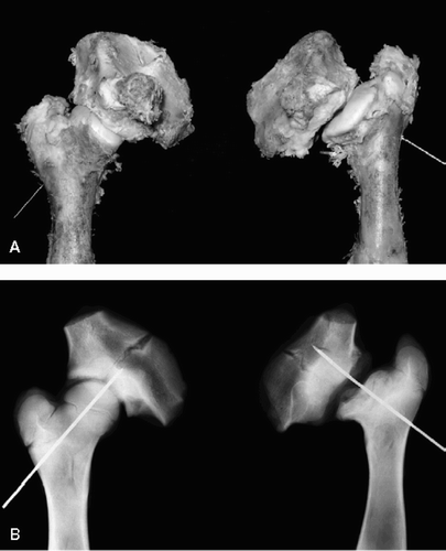 Figure 3. Gross (A) and radiographic (B) findings from extracted femurs from a piglet sacrificed at postoperative week 20 showing (to the right) subluxation of the femoral head with severe collapse of head and dysplasia of the acetabulum.