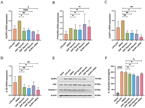 Figure 5 siRNA interference and AGP treatment inhibited the gene and protein expression levels of NLRP3 pathway in THP-1 derived macrophages. (A–D) The mRNA expression of NLRP3, PYCARD, CASP1 and IL1B. (E) Western blot analysis of NLRP3, ASC, and Caspase-1 protein levels. (F) IL-1β concentration in the culture supernatant for each group. The results were presented as the mean ± SEM, n = 3, *P < 0.05; **P < 0.01; ****P < 0.0001; ns, P > 0.05.