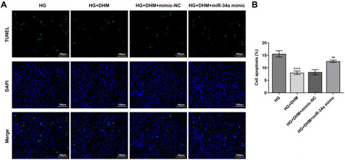 Figure 5 MiR-34a overexpression blocks the impact of DHM on apoptosis in HG-induced ARPE 19 cells. (A) Representative images of cell apoptosis. (B) The quantification of apoptotic cells. ***P<0.001 vs HG; ##P<0.01 vs HG+DHM+mimic-NC.