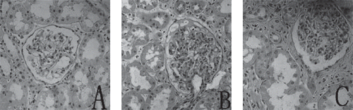 Figure 1. Representative micrographs of kidney tissue stained with HE from (A) NC, (B) DM, and (C) DM  +  TAU. Glomerular hypertrophy was evident in the untreated diabetic group, but glomerular size was reduced by taurine treatment. Original magnification × 400.