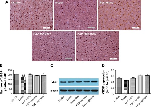 Figure 10 Effect of Fuzheng Quxie Decoction (FQD) on VEGF expression in brains of SAMP8 mice.