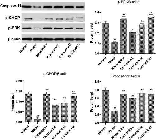 Figure 7. Effect of curcumin on the expression of ERK, CHOP and caspase-11 protein in rat brain tissue. Western blot was conducted to detect ERK, CHOP and caspase-11 protein levels. Compared with the normal, ##p < 0.01; compared with the model, *p < 0.05, **p < 0.01. Lane A: normal; lane B: model; lane C: nimodipine; lane D: curcumin-H; lane E: curcumin-M; lane F: curcumin-L.