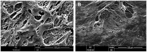 Figure 10 Scanning electron microscopic images of MG-63 cells cultured on multi(amino acid) copolymer (A) and 30 wt% nano calcium-deficient hydroxyapatite-multi(amino acid) copolymer composite (B) for 3 days.