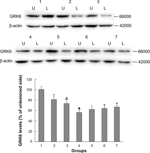 Figure 2 Western blotting results confirming the effect of administration of Tianqi antitremor granules on GRK6 expression in dyskinetic rats.