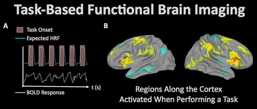 Figure 5. Task-related fMRI refers to the use of MRI to measure regional brain responses to cognitive and/or behavioral stimulation. (A) In the fMRI paradigm, an experimental task is performed at known times during imaging, and the resulting expected brain response (measured by MRI as the ‘hemodynamic response’ due to the phenomenon of neurovascular coupling) can be statistically analyzed to determine regions of the brain supporting the operations used to perform the task. (B) Activation patterns associated with behavioral fluctuations during a sustained attention task in 145 veterans from the TRACTS cohort (image courtesy of Dr. Michael Esterman, VA Boston Healthcare System).