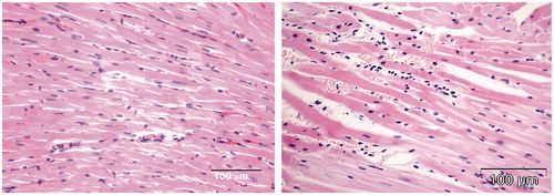 Figure 6. Histomorphological changes in the hearts of two rats treated with HPMA copolymer control (HE stain). Two rats treated with HPMA showed interstitial infiltration and hemorrhage (right micrograph). Left panel shows healthy myocardium in rats treated with saline.