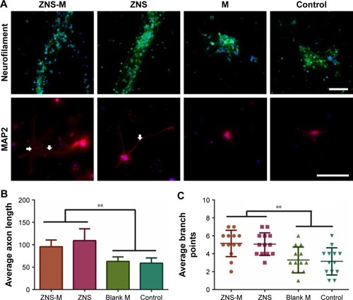 Figure 7 ZNS-M increases the number of branch points and neurite length in primary neuron cells.Notes: (A) The images of branch points (neurofilament; green) and axon lengths (MAP2; red) of neurons. Arrows indicate the elongated axons. (B) The neurite lengths and (C) the number of branch points were significantly increased in the ZNS-M group and the free ZNS group. Quantitative data are represented as mean ± SD. *P<0.05 was considered significant (**P<0.01). Scale bar =100 μm.Abbreviations: SD, standard deviation; M, micelles; ZNS, zonisamide; ZNS-M, zonisamide micelles.