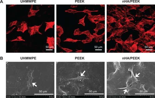 Figure 5 Cell spreading on the samples at 24 hours, as observed by (A) confocal laser scanning microscope and (B) scanning electron microscope.Note: Arrows indicate cells.Abbreviations: nHA/PEEK, nano-hydroxyapatite/polyetheretherketone; PEEK, polyetheretherketone; UHMWPE, ultra-high-molecular-weight polyethylene.