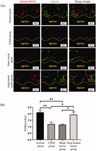 Figure 5. The assessment of new bone formation by the double fluorescence labeling method. (A) The image of the double fluorescence labeling observed under confocal laser scanning microscopy. (B) The mineral deposition rates. Scale bar = 200 μm. *p< .05; **p< .01.