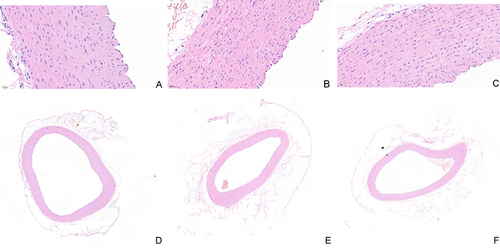 Figure 1 Guinea pig aortic arch was examined using H&E-stained microscope slides in each group. (A) Blank group (400x magnification). (B) Model group (400x magnification). (C) Intervention group (400x magnification). (D) Blank group (20x magnification). (E) Model group (20x magnification). (F) Intervention group (20x magnification).