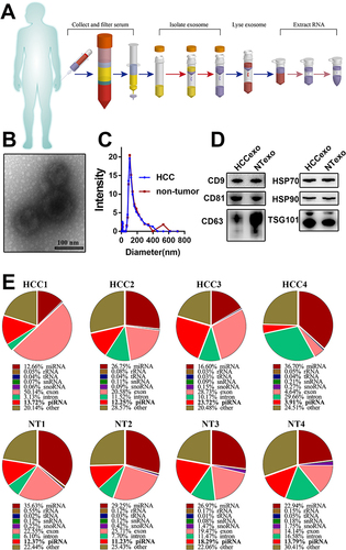 Figure 1 Analysis of serum exosome-derived piRNAs from HCC patients and non-tumour donors. (A) The flow diagram of exosome purification and RNA extraction from the serum of HCC patients. (B) The transmission electron micrograph showed the classic morphology of serum exosomes. (C) The hydrodynamic diameter distribution of the serum exosomes extracted from HCC patients and non-tumour donors. (D) Western blot detected the typical markers of exosomes (CD9, CD81, CD63, TSG101, HSP70, and HSP90) from HCC patients and non-tumour donors. (E) The proportion of piRNAs in serum exosomal small RNAs. Data were based on sRNA sequencing from 4 HCC patients and 4 non-tumour donors.