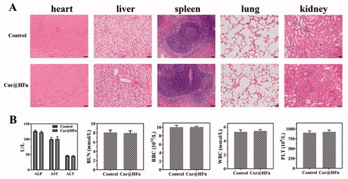 Figure 7. (A) Images of H&E stained major organs tissue sections of saline and Cur@HFn, (B) levels of alanine aminotransferase (ALT), aspartate aminotransferase (AST), alkaline phosphatase (ALP), blood urea nitrogen (BUN), red blood cell (RBC), white blood cell (WBC), and platelets (PLT).