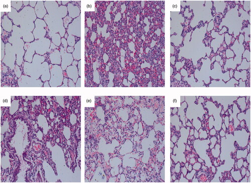 Figure 3. Effect of zukamu on the pathological morphology in rats (200×). Haematoxylin-eosin staining of the pathological morphology of right lung tissues in (a) control rats, (b) model rats, and rats treated by (c) DEX, (d) low-dose zukamu, (e) medium-dose zukamu and (f) high-dose zukamu.