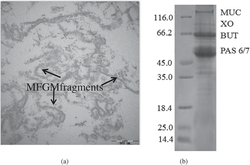 Figure 1. Transmission electron microscopy (TEM) images of the milk fat globule membrane: (a) dispersion; and (b) SDS-PAGE.