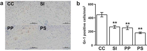 Figure 2. Dietary pomegranate polyphenol (PP) and soy isoflavone (SI) reduce the infiltration of myeloid cells in contact hypersensitivity (CHS) mice.(a) Immunohistochemistry images of auricle tissues stained with an anti-Gr-1 antibody. Dark brown, Gr-1-positive cells; blue, nuclei stained with hematoxylin. CC, CHS control group; SI, SI-treated group; PP, PP-treated group; PS, PP and SI-treated group. Scale bars, 100 mm. (b) The number of Gr-1-positive cells infiltrating the auricle tissues. The data are presented as the means ± SEM of the data obtained from two independent experiments (n = 6 mice per group); **p < 0.01 vs. CC.