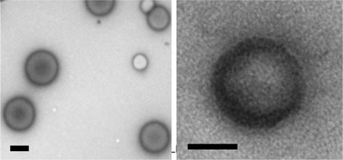 Figure 3 Transmission electron microscope photos of poly(ethylene glycol)-block-poly(D,L-lactic acid) vesicles. The structure of synthesized nanovesicles was clear, which was hollow and spherical. Particle size distribution was relatively homogeneous.