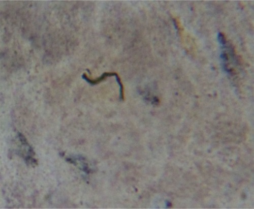 Figure 3 Spirochete detected with Dieterle silver stain in culture of skin sample from Morgellons disease patient.
