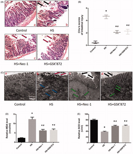 Figure 5. Nec-1 or GSK’872 pretreatment reduced HS-induced intestinal injury in vivo. Mice were pretreated with or without 1.8 mg/kg Nec-1 or 1.9 mmol/kg GSK’ 872 (intraperitoneal) at 1 h followed by exposure to a temperature controlled chamber (ambient temperature 35.5 ± 0.5 °C and 60 ± 5% relative humidity) until rectal core temperature (Tc) reached 42 °C. The mice were sacrificed at 20 h after HS exposure and the small intestine (ileum) was isolated. (A) Histopathology changes in the ileum were detected by H&E staining (magnification, ×200). HS resulted in profound damage to the small intestine epithelium, manifested as villous stroma broadening, focal necrosis, and some epithelial cell detachment accompanied by marked edema and congestion (A-b, black arrows). (B) Intestinal injury was evaluated by Chiu scores in mice. (C) The ileum ultrastructure was observed by TEM. Changes in microvillus height (C-b, red arrows), and mitochondria (C-b, blue arrows) were apparent in the HS group ileum. (D) Quantification of the malondialdehyde (MDA) levels induced by HS. E. Quantification of the superoxide dismutase (SOD) levels induced by HS. *p < 0.05, compared to the control (37 °C) group; #p < 0.05, compared to the HS group, (n = 6).