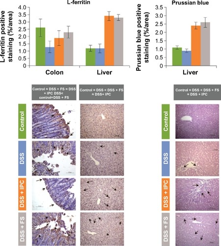 Figure 2 Immunohistochemical assessment of L-ferritin expression in rat colon and liver, and levels of iron deposits in rat liver (Prussian blue).