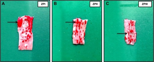 Figure 11 Photographs of aortic arches stained with Sudan IV dye (sudanophilia) reveal the effect of ZER supplementation on atherosclerotic plaque formation and development.