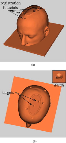 Figure 8. Two views of the phantom model created from MRI data, augmented with registration fiducials and target fiducials inside the skull. The detail shows the geometry of the fiducial. (a) Side view. (b) Top view. [colour version available online.]