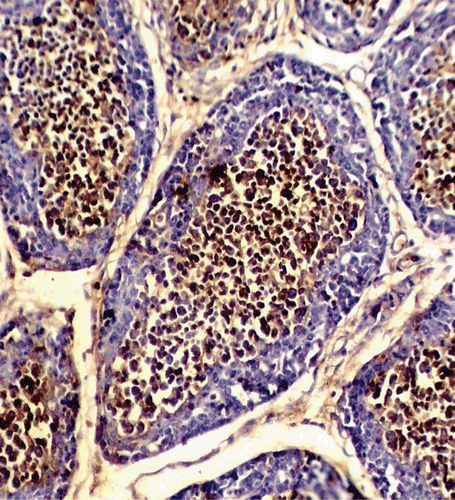 Figure 1.  Photomicrograph of bursa of Fabricius from representative progeny chick of a Group A hen (control) fed OTA-free feed. IgG-bearing cells in medullary region shown here display positive DAB staining (DAB & Hematoxylin stain; 100× magnification).