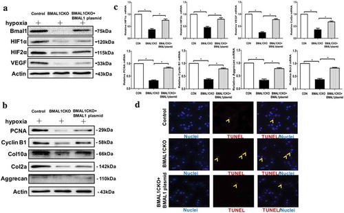 Figure 7. Recovery of Bmal1 expression improved the chondrocytes function. (a) For the rescue experiment, chondrocytes from BMAL1CKO mice were transfected with overexpressed Bmal1 plasmid, the expression of Bmal1, HIF1α, HIF2α and VEGF were detected by Western blot. (b) Proliferation and differentiation of the BMAL1CKO mice chondrocytes were partly recovered by transfection of overexpression plasmid for Bmal1. (c) Relative mRNA expression level of several factors for proliferation, differentiation and apoptosis in BMAL1CKO chondrocytes transfected with Bmal1 overexpression plasmid was detected by qPCR test (n= 3/group). Results were presented as gene expression levels in all groups normalized to controls. (d) Overexpression of Bmal1 decreased the number of TUNEL-positive cells in cultured BMAL1CKO mice chondrocytes. The representative TUNEL positive cells were labeled by red fluorescence (n= 3/group). Data are expressed as means ± SE in each bar graph. *p < 0.05.