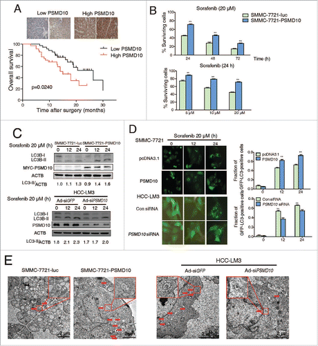 Figure 8. PSMD10 resisted apoptosis and enhanced autophagy under sorafenib treatment. (A) Representative PSMD10 expression in TMAs from 70 patients with HCC who underwent liver resection and sorafenib therapy (upper panel). Overall survival rates were compared between the low-PSMD10 (below the median value, n = 35) and high-PSMD10 groups (above the median value, n = 35) (lower panel). (B) SMMC-7721-luc or SMMC-7721-PSMD10 cells were treated with sorafenib (20 μM) for the indicated time or with the indicated dosage for 24 h. (C) LC3B-II was immunoblotted in SMMC-7721 or HCC-LM3 cells after sorafenib (20 μM) treatment for the indicated time. (D) The formation of LC3 puncta was detected in the indicated cells exposed to 20 μM sorafenib for 12 or 24 h. Quantification of the ratio of LC3 punctate cells to overall cells was shown in right panel. (E) Electron microscopy analysis showed autophagic vesicles or autophagosomes in cells from (D).