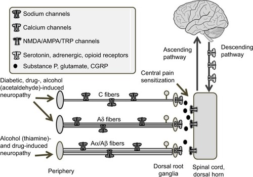 Figure 1 Overview of neuropathies affecting pain pathways.
