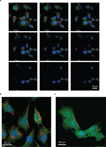 Figure 2 Confocal analysis of BNNT internalization a) and investigation of its mechanism: BNNT uptake b) and its inhibition after treatment with sodium azide c).