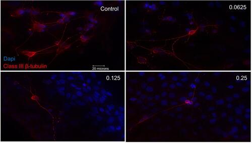 Figure S3 Morphological effect of different concentrations of ranibizumab on retinal ganglion cells (RGCs) following 48 hrs post-treatment. RGCs were stained for nuclei (blue) and Class III β-tubulin (red). Immunofluorescence of RGCs under different concentrations of ranibizumab for 48 hrs showed that as the concentration increased, the morphology of the RGCs changed. As the concentration went from untreated control to double the clinical dose (0.25 mg/mL), the number of RGCs decreased, had fewer contacts between each other, and had fewer dendritic outgrowths. Magnification x60. Scale bar: 20 µm.