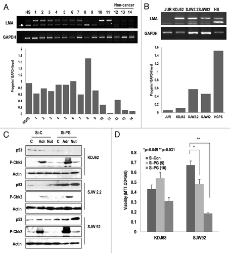 Figure 6. Elevated expression of progerin in human leukemia samples. (A) A large portion of leukemia samples express progerin. Using RT-PCR, we explored the expression of progerin and found that among 11 leukemia samples (1–11), 9 samples expressed progerin (arrow). In contrast, normal samples did not show progerin expression (12–14). HGPS (HS) cells were used as a positive control of progerin. Among them, 5 samples (#1, 3, 5, 7, and 8) exhibited a smaller band that was confirmed to correspond to progerin using the cloning and sequencing method. The relative expression of progerin/GAPDH was provided as a graph (below). (B) Progerin expression in 3 established cell lines. Using the patient’s white blood cells, 3 types of cell lines were established (KDJ62 from #11, SJW2.2 from #8, and SJW92 from #2). Among them, two cell lines (SJW2.2 and SJW92) expressed progerin. Jurkat (JUR) and HGPS (HS) were used for control cell lines. The relative expression of progerin/GAPDH was provided as a graph (below). (C) Si-progerin (Si-PG) enhances p53 expression and the DNA damage response. In progerin-positive cell lines (SJW2.2 and SJW92), si-PG enhanced the responsibility of p53 and p-Chk2 to adriamycin (Adr) and Nutlin-3 (Nut). In contrast, KDJ62 did not show a significant difference. (D) Si-progerin (Si-PG) suppressed the cell viability in a progerin-dependent manner. Si-PG suppressed the cell viability in SJW92 cell lines. In contrast, KDJ62 did not show a reduction of viability. Cells were transfected with 5 or 10 μg/ml of si-progerin for 24 h.