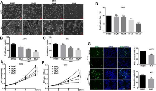 Figure 2 Dehydrocorydaline inhibits cell growth and proliferation in human melanoma cells. (A) Cell morphology of A375 and MV3 melanoma cells after treating with DMSO or the indicated concentrations of DHC for 48 h. Scale bar, 100 μm. (B and C) The effect of DHC on the proliferation rates of A375 and MV3 cells determined by cell counting in the microscope. (D) The effect of different concentrations of DHC treatment for 48 h on the proliferation rate of PIG1 cells determined by MTT assay. (E and F) The effect of DHC on the viability of A375 and MV3 cells. (G) Images and quantifications of A375 and MV3 cells positive for BrdU staining after treating with DMSO or 40 μM DHC for 24 h. Scale bar, 100 μm. All data are shown as the mean ± SD. A two-tailed unpaired Student’s t-test was carried out. *p<0.05, **p<0.01, ***p<0.001, ****p<0.0001.