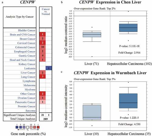 Figure 1. Analysis of CENPW differential expression in the Oncomine database. (a) CENPW expression levels in different types of human cancers compared to normal tissues. Upregulation is shown in red, while downregulation is shown in blue. (b, c) Box plot showing CENPW mRNA levels in the Chen Liver and Wurmbach Liver datasets.