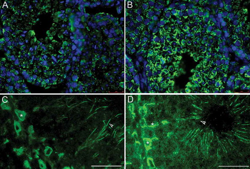 Figure 1. Immunofluorescence localization of galactosyl-alkyl-acyl-glycerol (GalAAG) in the testis of wild type (A,C) and twitcher mice (B,D) of tubules from stage VII-VIII. GalAAG (green) accumulation in Sertoli cell cytoplasm (asterisk) and spermatid tails (arrow head) is evident. Nuclei are stained in blue. Scale bar 25 μm.
