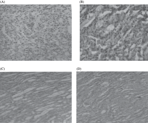 Figure 3. Photomicrographs of kidney sections of rat stained with hematoxylin and eosin (×100). (A) Haematoxylin- and eosin-stained sections of normal rat kidneys; (B) kidney section of CIS-treated rats showing tubular brush border loss and necrosis of epithelium; (C) kidney section of CIS + EEAFA, 50 mg-treated rats showing prevention of CIS-induced alterations; (D) kidney section of CIS + EEAFA, 100 mg-treated rats showing prevention of CIS-induced alterations.