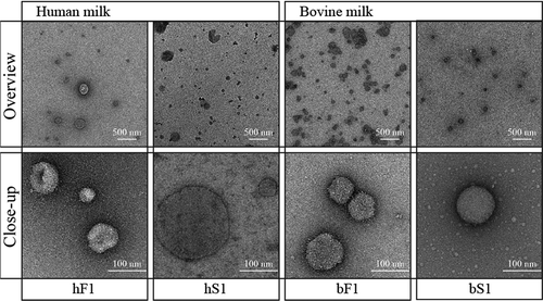 Figure 4. Morphology of MEV isolates by transmission electron microscopy. Freshly prepared MEV isolates from pooled fractions of the first SEC peaks were stained with a 1% uranyl formate solution and imaged in the concentration they were eluted from the column. Abbreviations: SEC, size-exclusion chromatography; hF1, human fluff MEV; hS1, human milk serum MEV; bF1, bovine fluff MEV; bS1, bovine milk serum MEV.