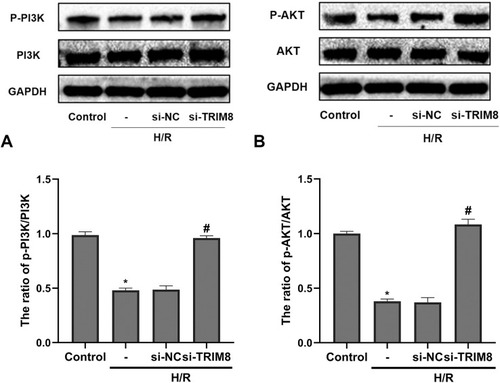 Figure 5 PI3K/Akt signaling pathway was involved in TRIM8 inhibition-regulated H/R injury in HK-2 cells. (A) Western-blot analysis for the protein expression of PI3K, p-PI3K in the indicated groups and quantitative analysis of p-PI3K/PI3K. (B) Western-blot analysis for the protein expression of AKT, p-AKT in different groups and quantitative analysis of p-AKT/AKT. All results are from three independent experiments. Data are presented as mean +SD.*P < 0.05, relative to control group; #P < 0.05, relative to the H/R + si-NC group.
