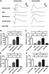 Figure 3 (A) The light stimulus induced large electroretinography (ERG) responses in mice of the normal control group. The ERG responses in the N-methyl-N-nitrosourea (MNU) group were terribly abolished. (B-C) The scotopic and photopic a-wave amplitudes in the MNU+taurine group was significantly larger than those in the MNU group. (D-E) The scotopic and scotopic b-wave amplitudes in the MNU group were significantly smaller compared with the normal control group. Conversely, the scotopic and photopic b-wave amplitudes in the MNU+taurine group were significantly larger than those in the MNU group, suggesting that the taurine treatment prevented the ERG functional reduction in the MNU-administered mice (ANOVA analysis followed by Bonferroni’s post-hoc analysis was performed, #P<0.01, for differences between groups; n=10).