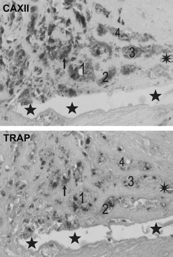 Figure 6. Mirror image section images demonstrating co-localization of CAXII protein with TRAP in human atherosclerotic plaques in representative carotid plaques. Corresponding cells, cell clusters, and microanatomic structures are indicated by an arrow-head, numbers 1–4, stars, and an asterisk.