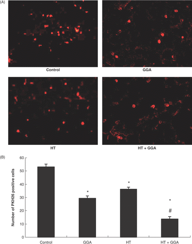 Figure 6. Colon26 cells stained with PKH26 in the lungs. (A) Microscopic observation of experimental lung metastases from untreated, GGA pretreated, hyperthermia pretreated, and GGA plus hyperthermia pretreated groups with the fluorescent dye PKH26 using a fluorescent microscope. (B) Statistical results of microscopic findings of experimental lung metastases by colon26 cells with PKH26. We counted the number of microscopic PKH26-positive cells 24 h after cancer cell injection. We estimated five views with 200× magnification for each group. Data are presented as the mean ± SEM of five mice. *P < 0.001 compared with the control, #P < 0.001 compared with GGA group and hyperthermia group.